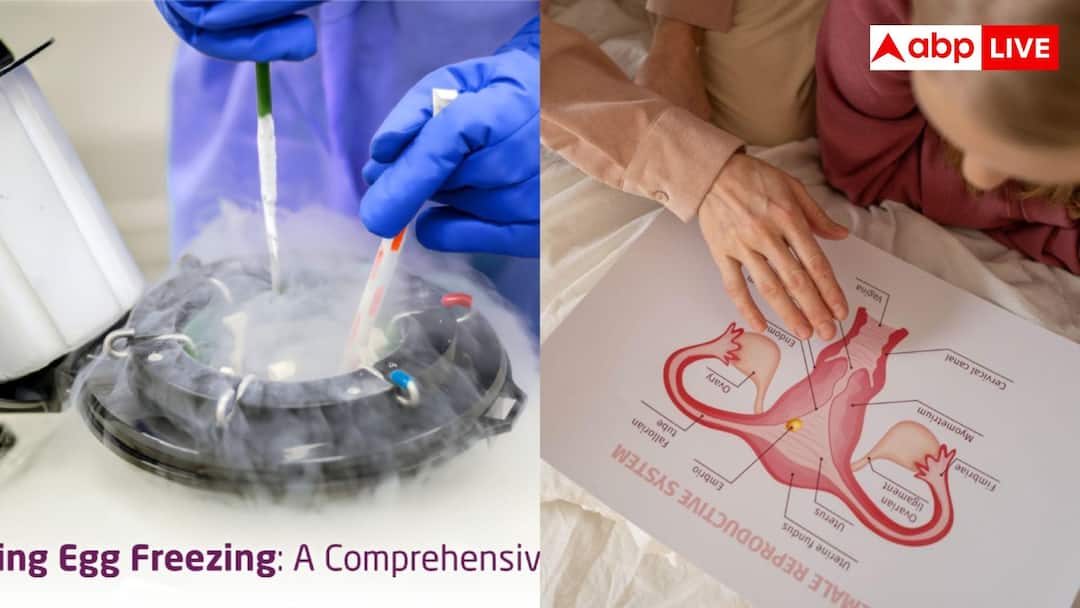 Egg Freezing VS IVF Treatment: Planning to become a mother? Egg Freezing or IVF… What to Choose?