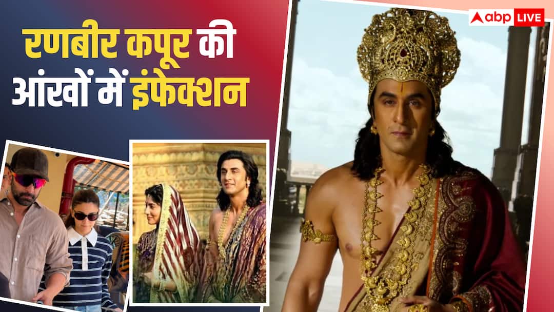 Ranbir Kapoor suffers from conjunctivitis just before ‘Ramayana’ trailer launch, will the actor attend the Delhi event?